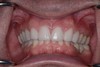 after dental procedure 7