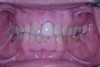 before dental procedure 1