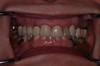 before dental procedure 4