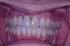 before dental procedure 6