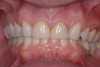 before dental procedure 7