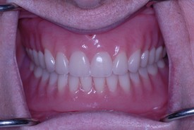 after dental procedure 8