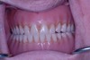 before dental procedure 8