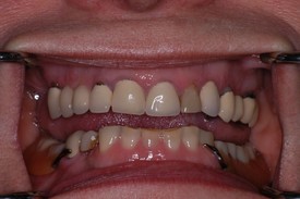 before dental procedure 10