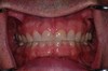 before dental procedure 13