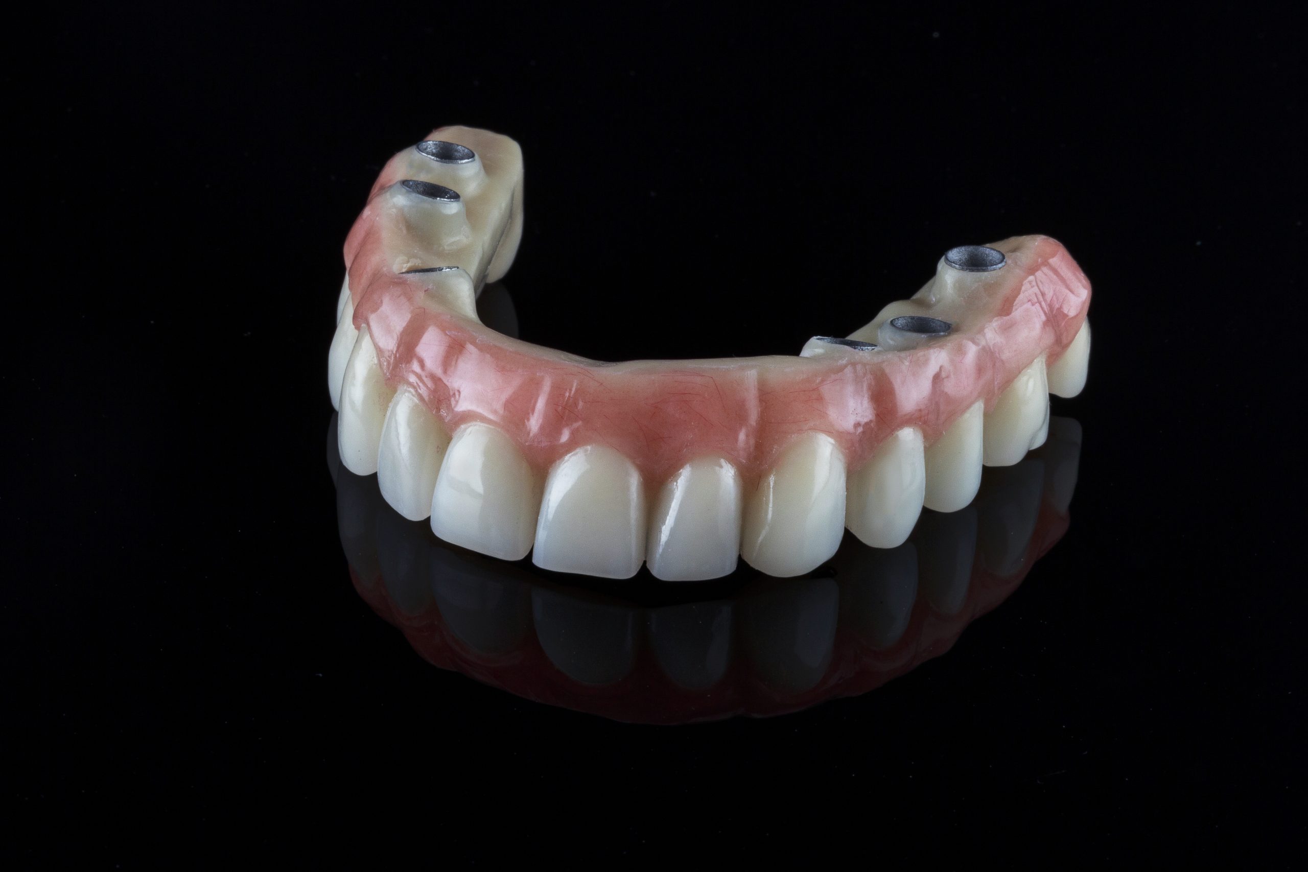 realistic dental permanent upper jaw prosthesis for a 50-year-old patient on a black background