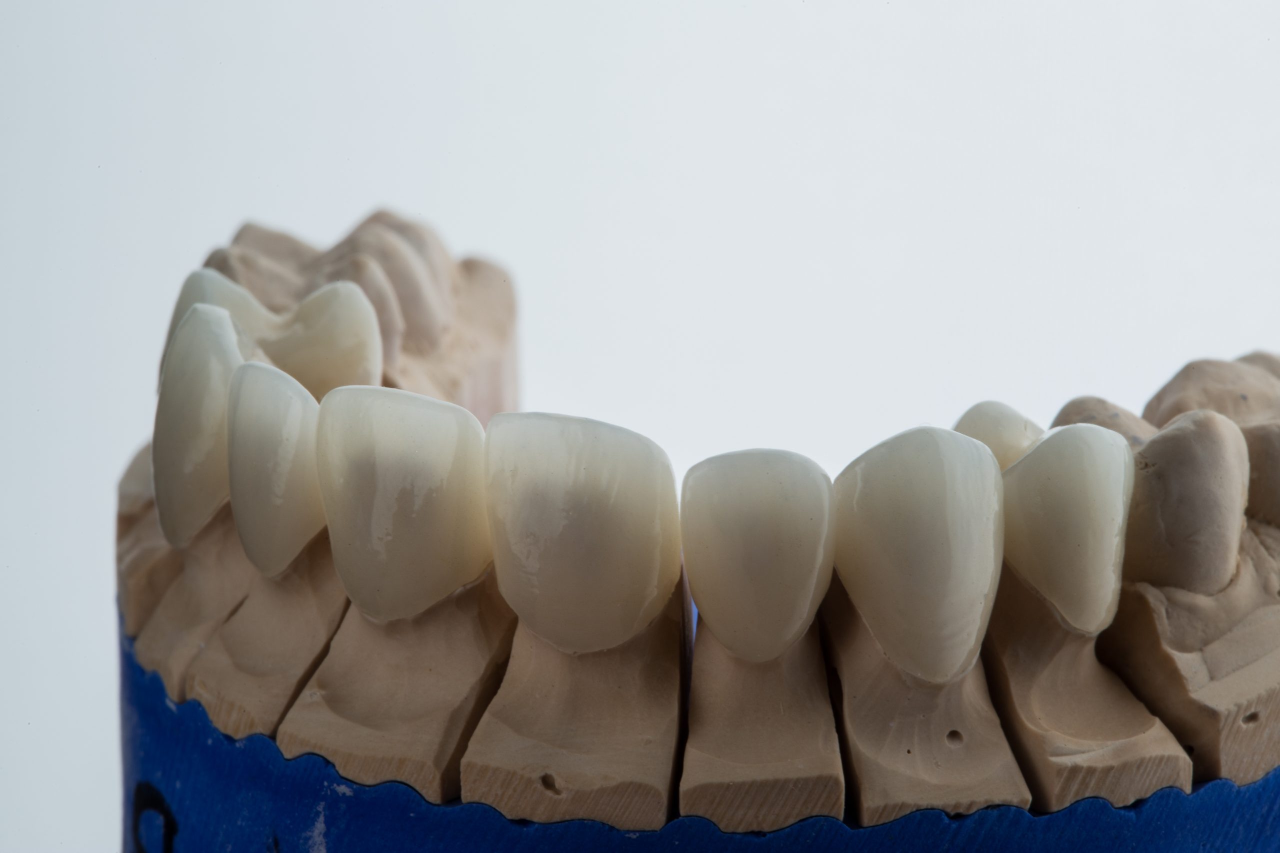 mock dental implants